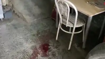 Sandalyeden Düşen Adamın Korkutucu Kazası: Ağır Yaralanma Raporu!