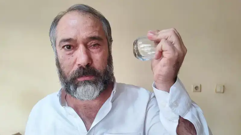 Küfür Eden Çaycıyla Tartışan Adamın Gözünü Kaybetmesi Sosyal Medyayı Salladı