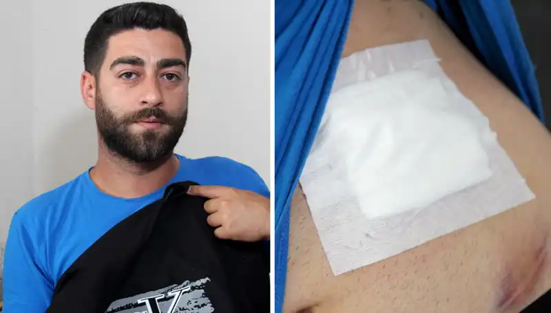 Karnındaki Ağrının Sırrı Röntgende Ortaya Çıktı: Gerçekler Şoke Etti