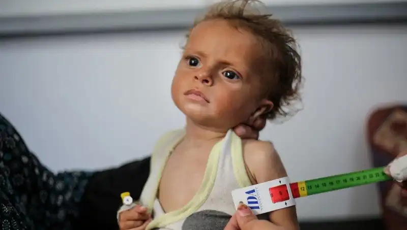 İngiltere, Gazze'den Gelen 300 Çocuğa Umut Kapısını Araladı